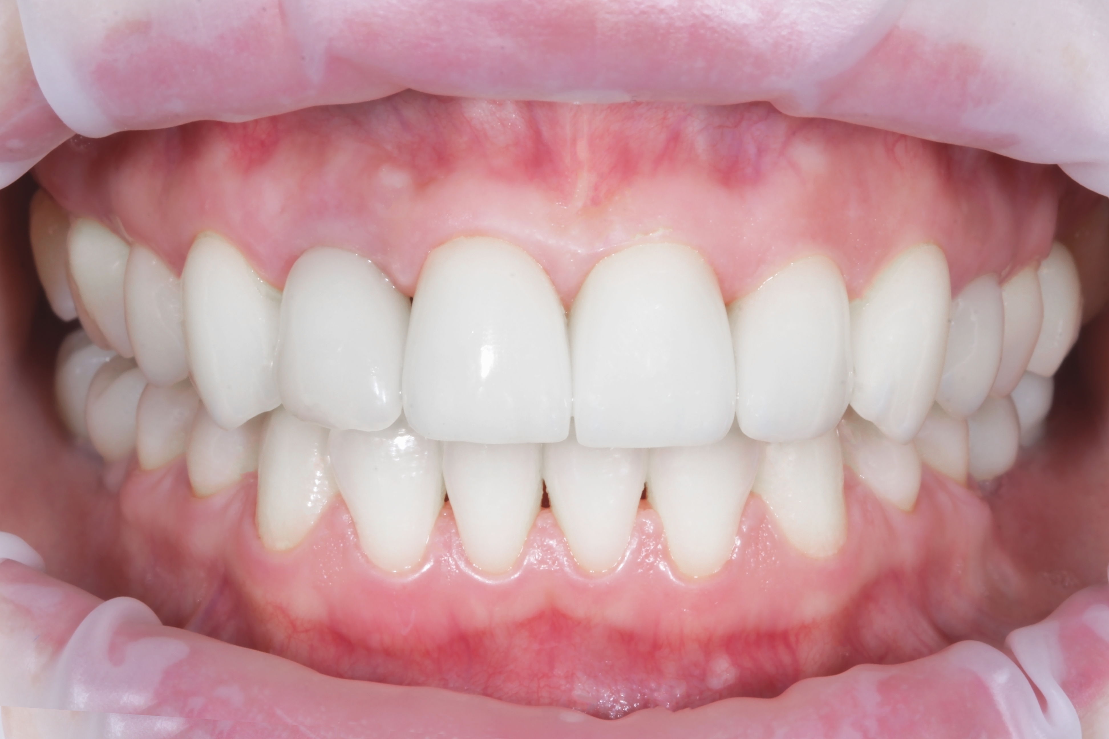 Estética Dentária