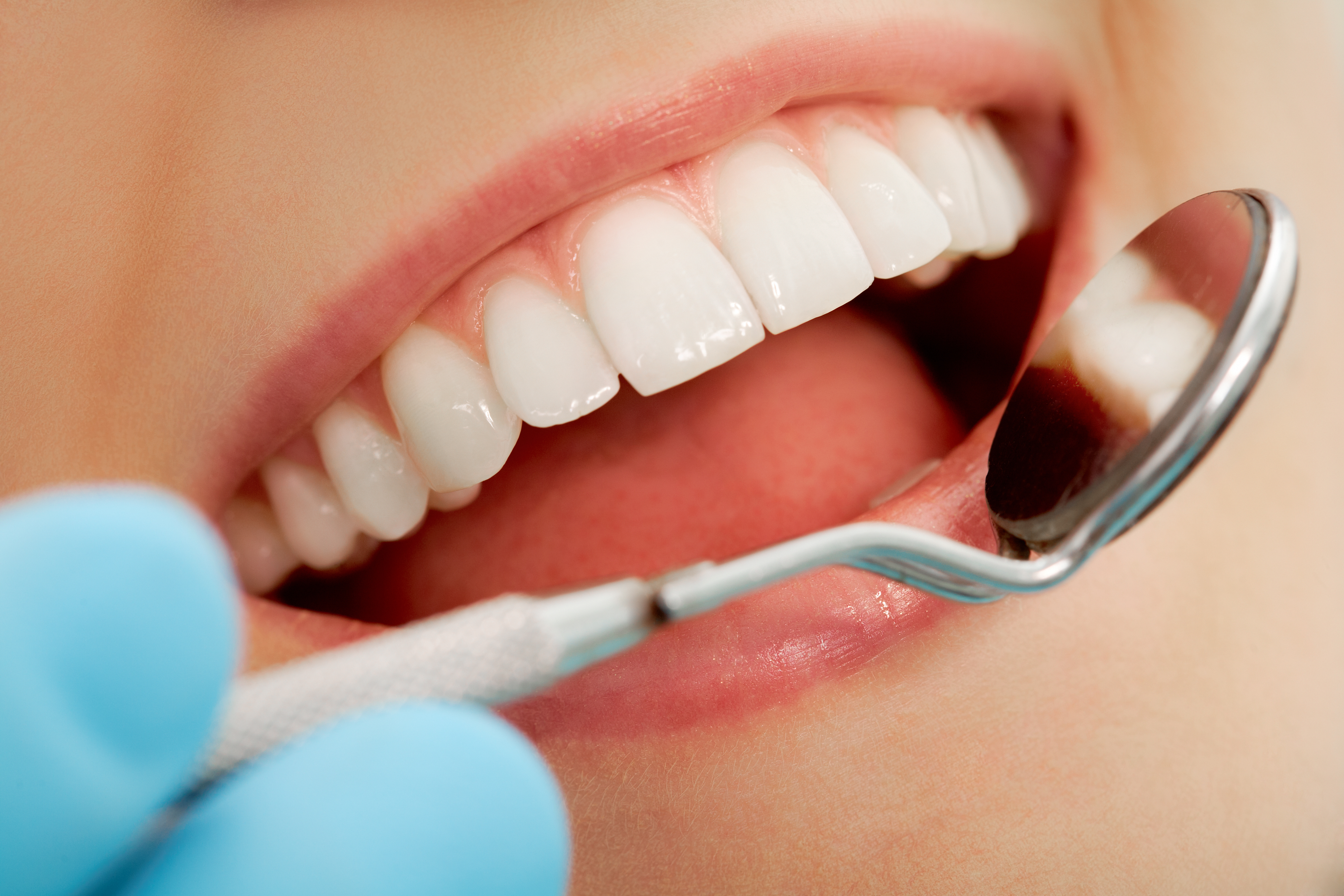 Benefícios da Higiene Oral