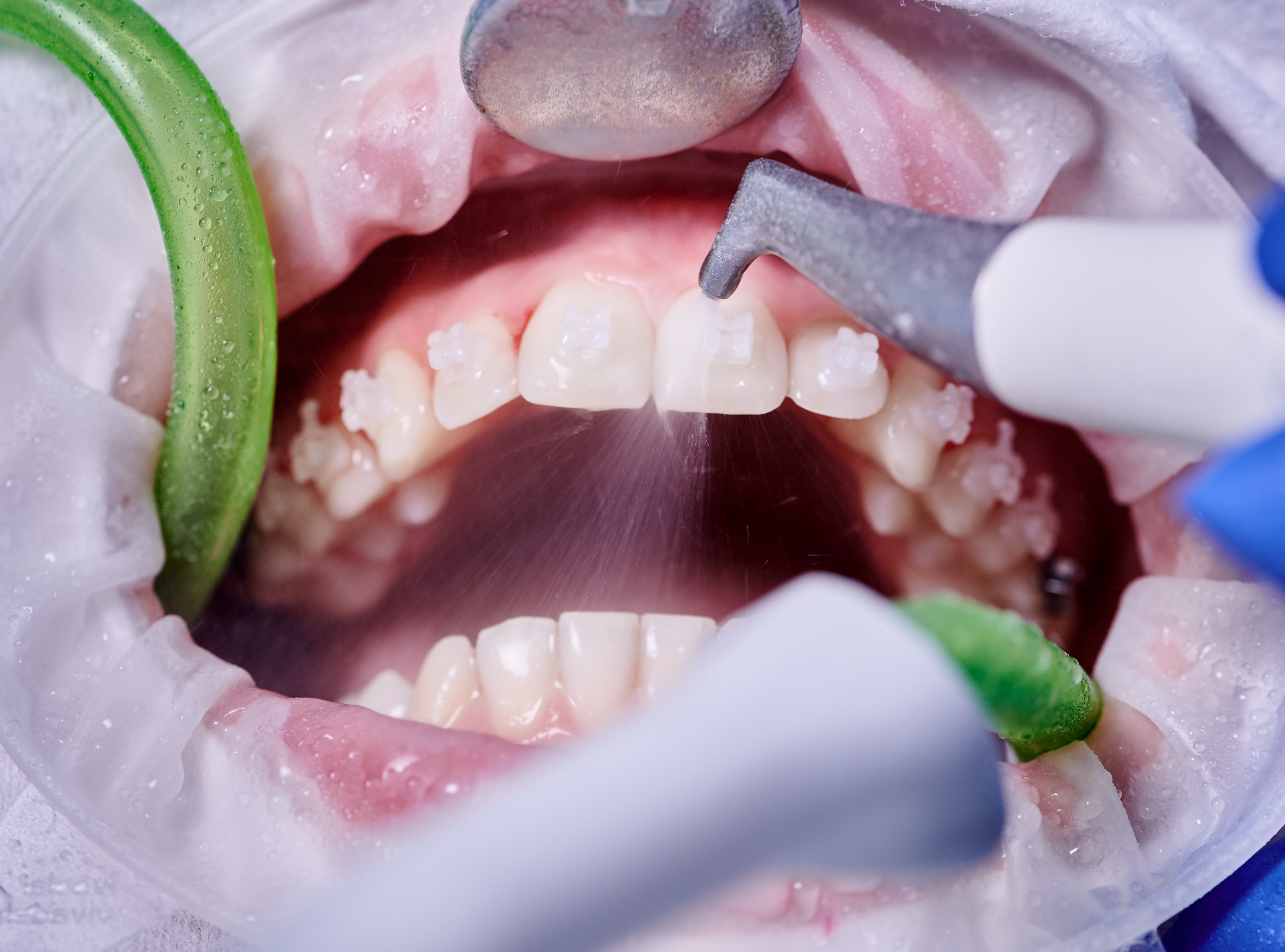 Consulta de Higiene Oral