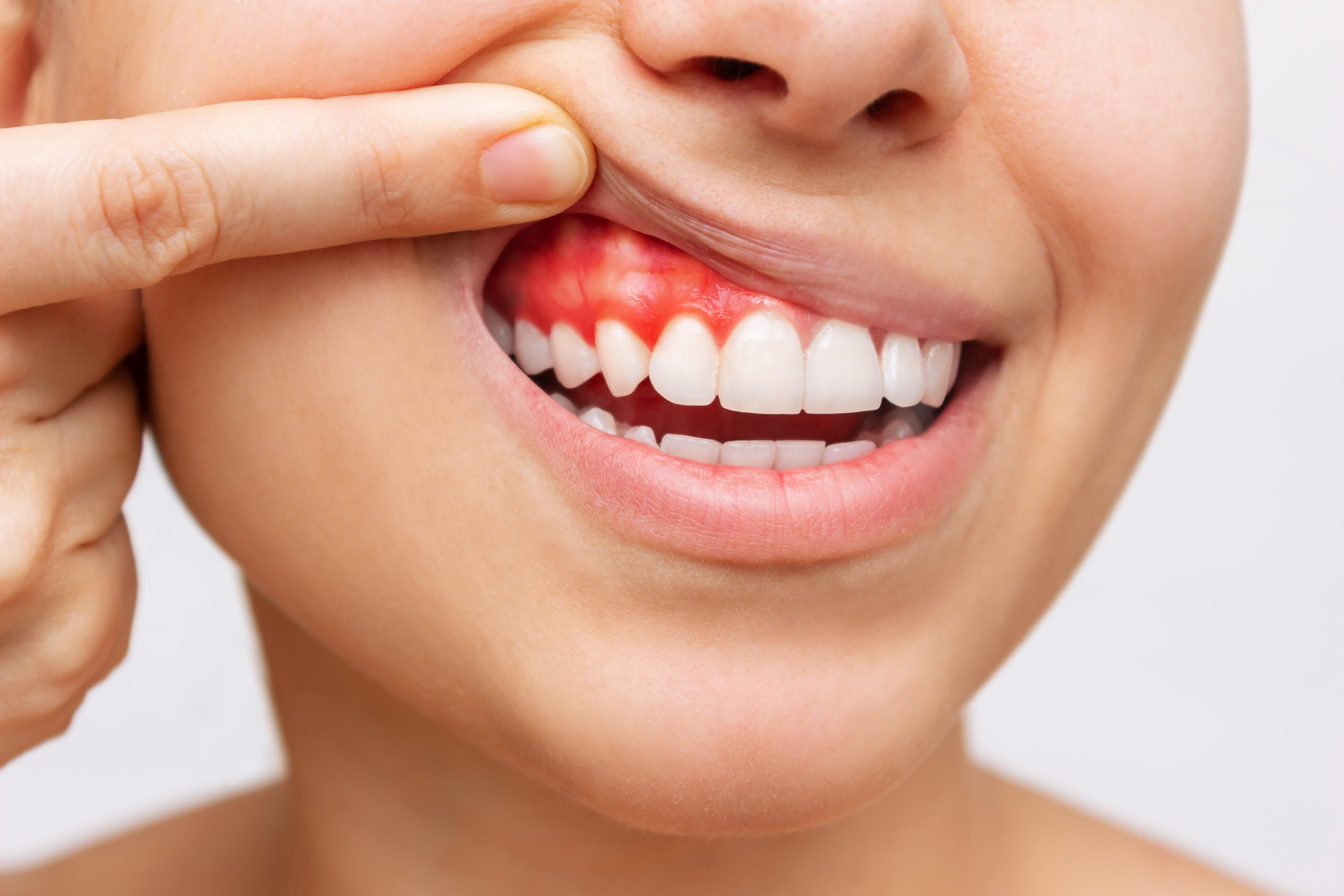 Periodontologia