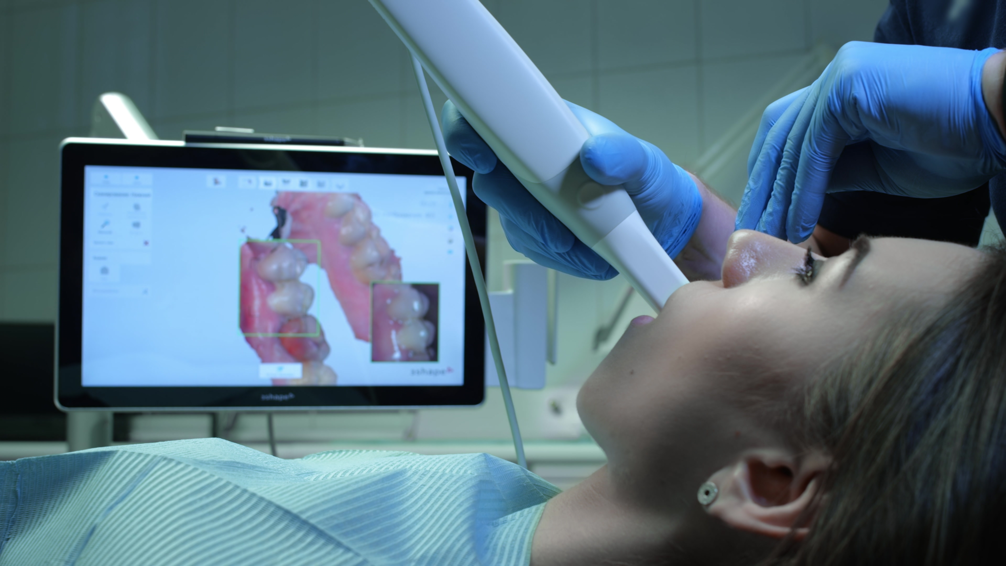 Scanner intra-oral